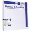 Рентгеновская пленка синечувствительная, SFM X-Ray BF, КОМПЛЕКТ 100 л., 35х35 см, 629042 - фото 2709437