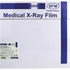 Рентгеновская пленка синечувствительная, SFM X-Ray BF, КОМПЛЕКТ 100 л., 35х35 см, 629042 - фото 2710013